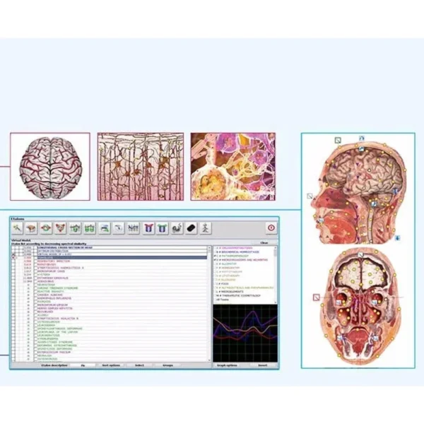 Multifunction Metatron 4025 Hunter Bioresonance NLS Bioresonance Therapy Machine - Image 5